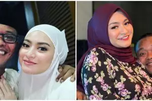 Nathalie Holscher unggah foto USG, paras sang bayi plek ketiplek Sule