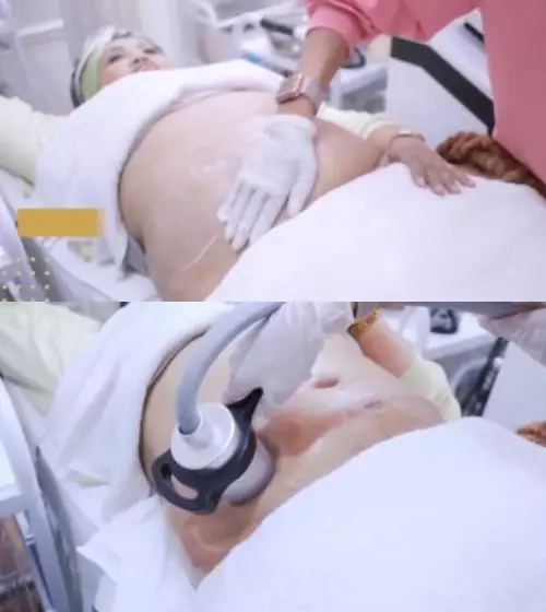 Elly Sugigi sebelum dan sesudah perawatan dari berbagai sumber