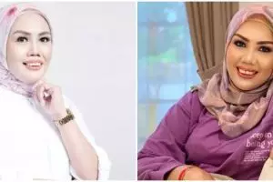 5 Potret Elly Sugigi sebelum dan sesudah perawatan kecantikan