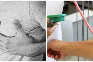 Mengenal aterosklerosis, penyakit kelainan pada pembuluh arteri