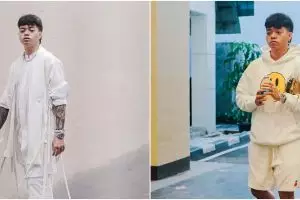 Alami pergeseran tulang belakang, Reza Arap akui alami depresi