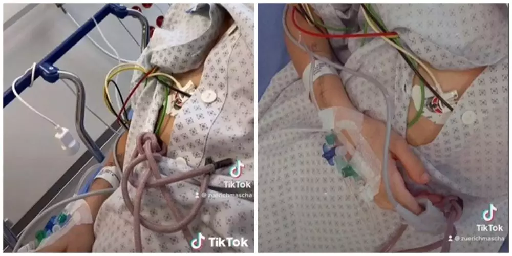 Akibat kecanduan minuman kaleng © TikTok Akibat kecanduan minuman kaleng © TikTok