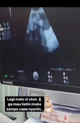 Lesty Kejora jalani USG ditemani Rizky Billar © berbagai sumber