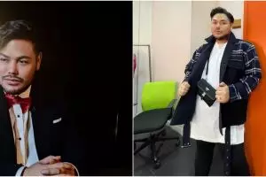 5 Perawatan Ivan Gunawan agar tampil maksimal, oplas rogoh Rp 150 juta