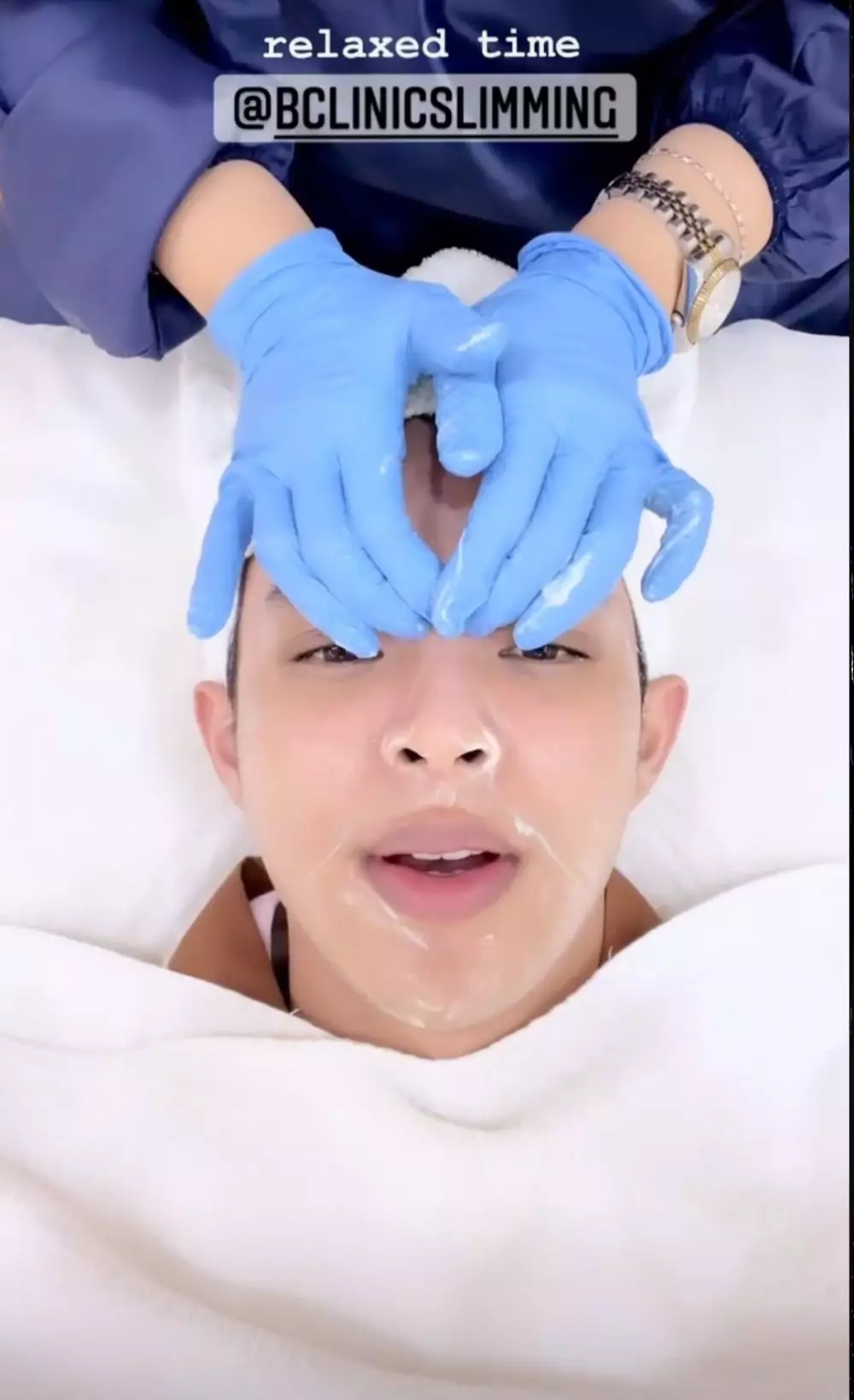 Perawatan Rey Mbayang © 2021 brilio.net