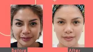 Perawatan kecantikan Nikita Mirzani © 2021 brilio.net Perawatan kecantikan Nikita Mirzani © 2021 brilio.net