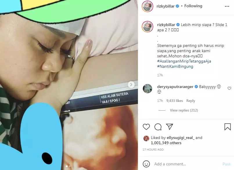 Rizky Billar unggah foto USG © 2021 Instagram Rizky Billar unggah foto USG © 2021 Instagram