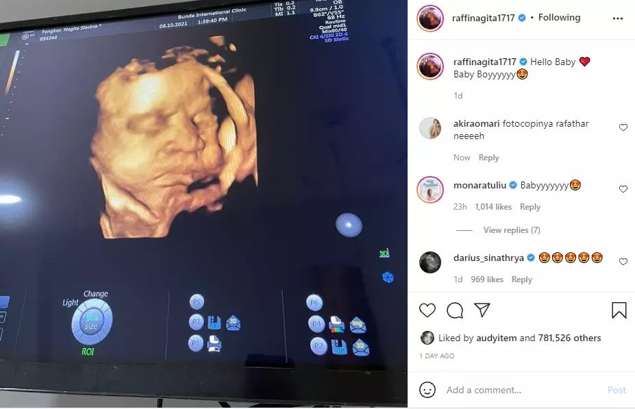 paras calon bayi disebut fotocopy-an Rafathar Instagram paras calon bayi disebut fotocopy-an Rafathar Instagram