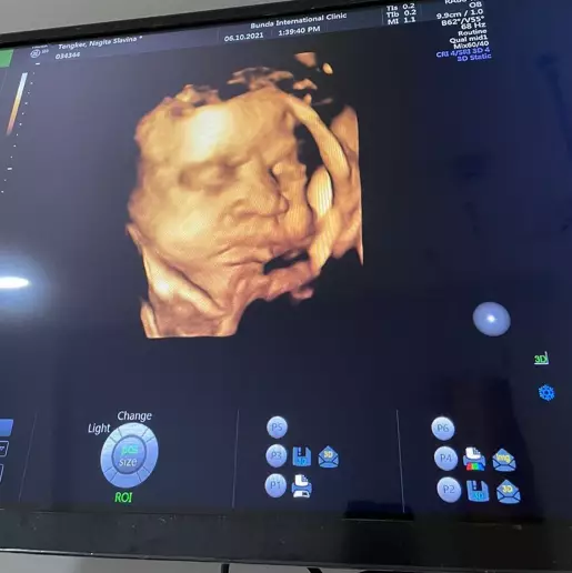 Adik Rafathar Instagram Adik Rafathar Instagram