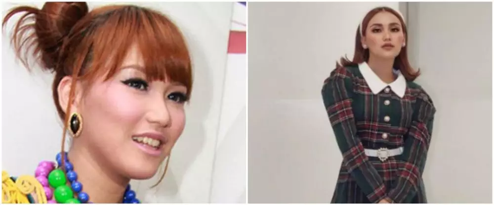 Ayu Ting Ting dulu dan kini dari berbagai sumber Ayu Ting Ting dulu dan kini dari berbagai sumber