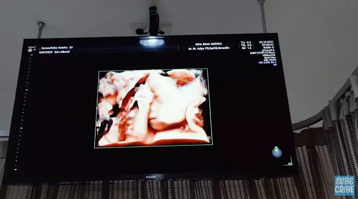 momen kesha ratuliu cek kandungan © YouTube