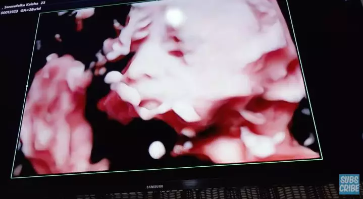 momen kesha ratuliu cek kandungan © YouTube