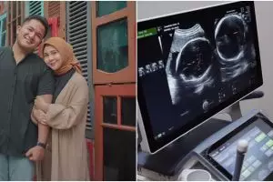 9 Momen Kesha Ratuliu cek kandungan, Mona histeris lihat hasil USG