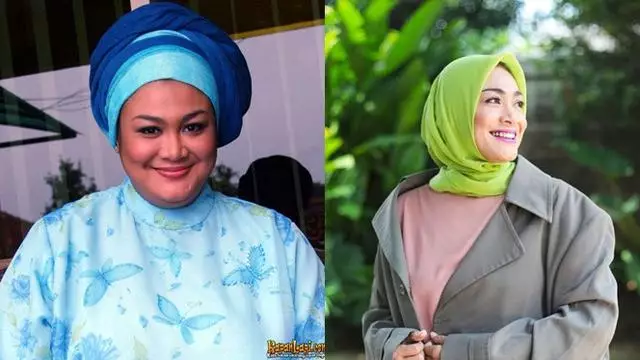 presenter before after diet Berbagai sumber  presenter before after diet Berbagai sumber