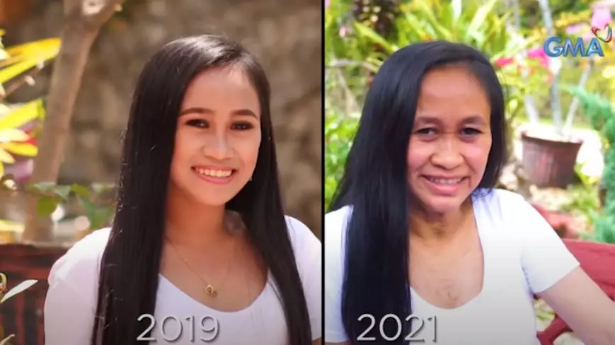 Gadis 16 tahun tampil seperti nenek © Istimewa Gadis 16 tahun tampil seperti nenek © Istimewa