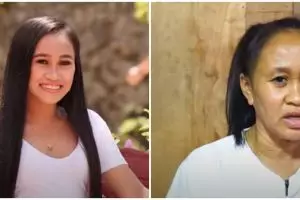 Gadis 16 tahun tampak seperti nenek akibat kondisi langka progeria