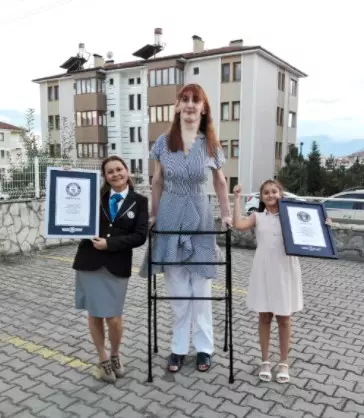 wanita Turki ini tertinggi di dunia © Guinness World Records