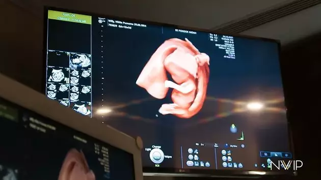 Nikita willy jalani usg © 2021 YouTube