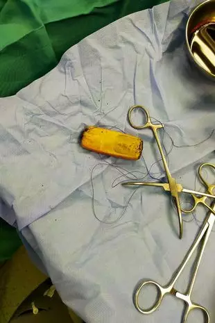 Dokter kaget temukan ponsel di perut seorang pria Berbagai sumber Dokter kaget temukan ponsel di perut seorang pria Berbagai sumber