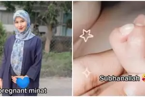 Anak terlahir dengan 6 jari, ibu ini bersyukur karena mirip idolanya