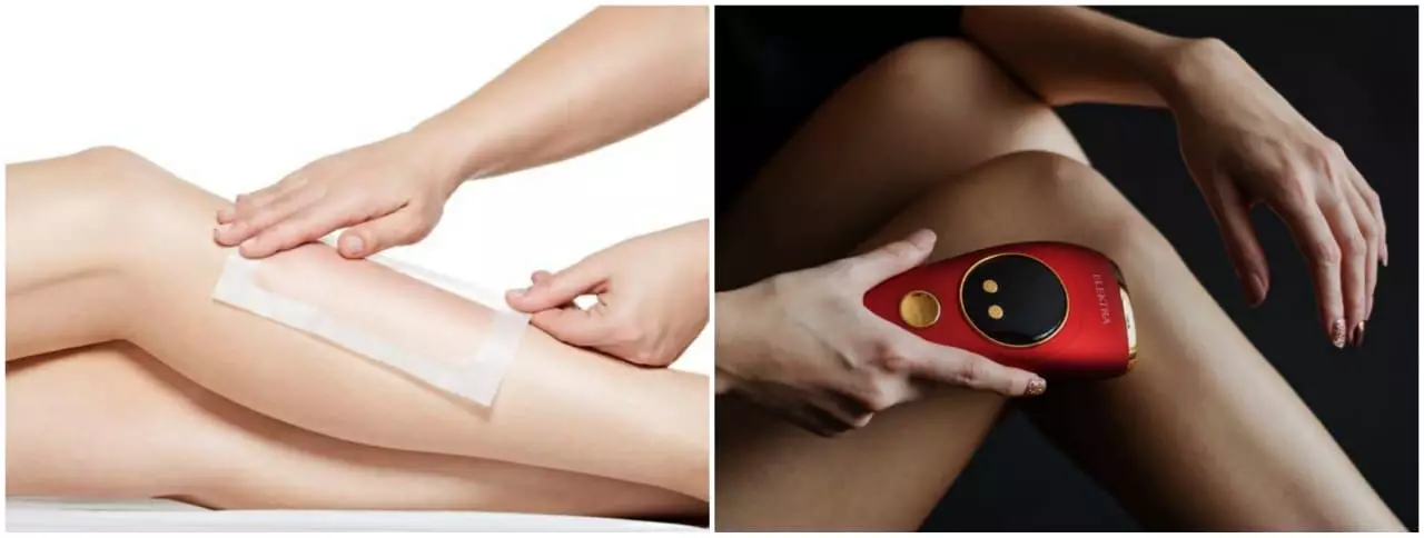 Mengenal IPL hair removal, treatement hilangkan bulu tanpa rasa sakit