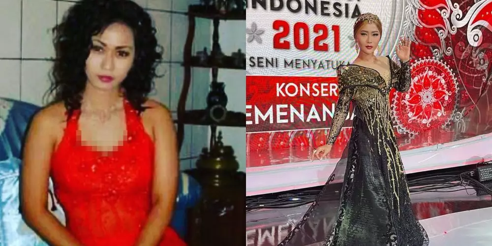 potret dulu dan kini inul daratista © berbagai sumber