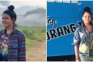 Kondisi terbaru Melanie Subono usai jalani operasi pengangkatan tumor