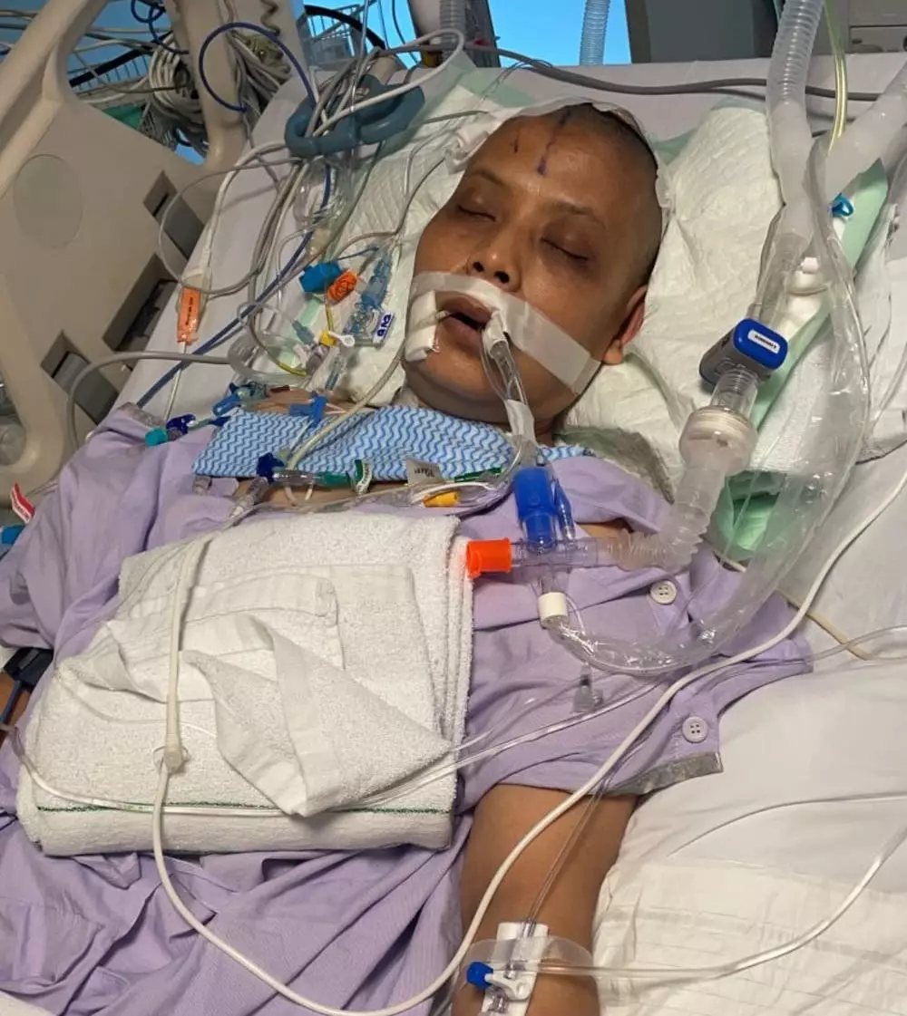 ART Indonesia alami aneurima otak © Facebook ART Indonesia alami aneurima otak © Facebook