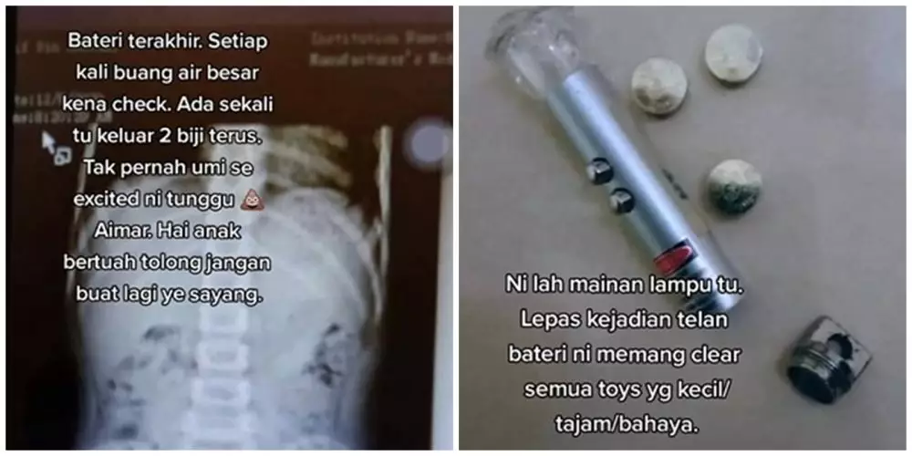 Anak menelan baterai © TikTok Anak menelan baterai © TikTok