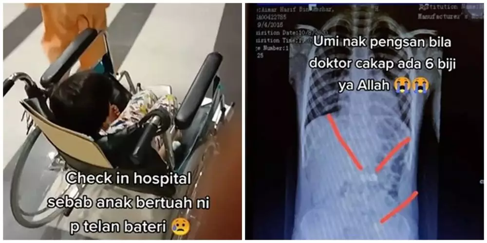 Anak menelan baterai © TikTok Anak menelan baterai © TikTok