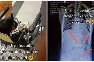 Cerita ibu hadapi anak menelan 6 baterai, panik lihat hasil X-Ray
