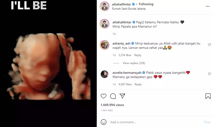 USG anak Aurel © 2021 Instagram