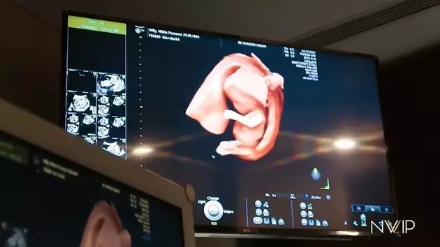 perjuangan nikita willy hamil © YouTube