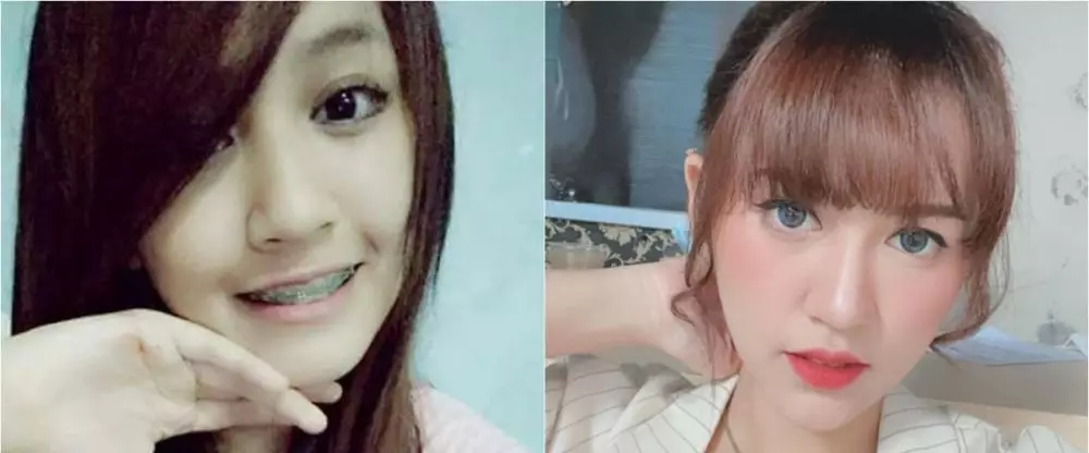 Potret dulu dan kini penyanyi koplo © berbagai sumber Potret dulu dan kini penyanyi koplo © berbagai sumber