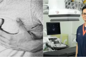 Pasien kanker berisiko terkena masalah jantung, ini cara mengatasinya