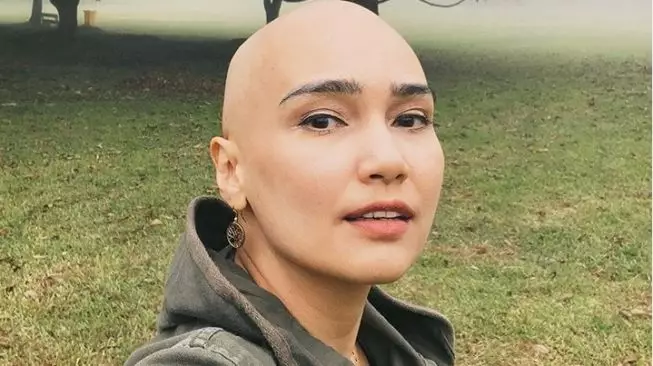 Kisah perjuangan seleb lawan tumor Berbagai sumber 