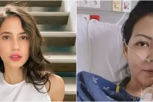 Perjuangan 7 seleb lawan tumor, Melanie Subono sampai angkat rahim