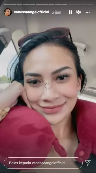 vanesa kecelakaan mobil © 2021 Instagram vanesa kecelakaan mobil © 2021 Instagram