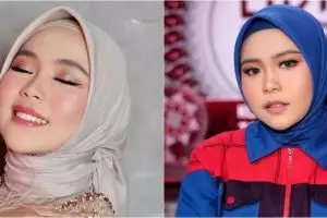7 Perawatan kecantikan Selfi LIDA, dari infus whitening hingga filler