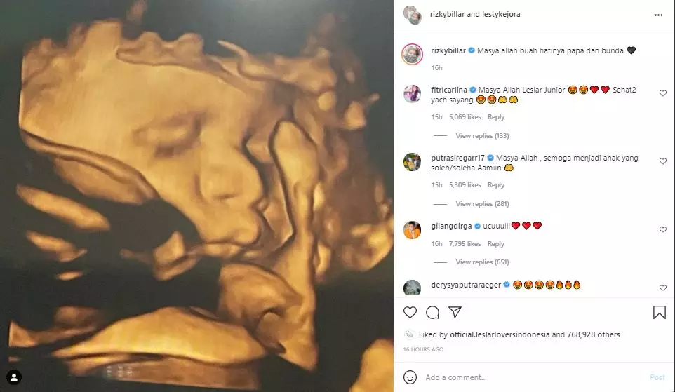 USG dan panggilan baru Lesty Billar © 2021 brilio.net USG dan panggilan baru Lesty Billar © 2021 brilio.net