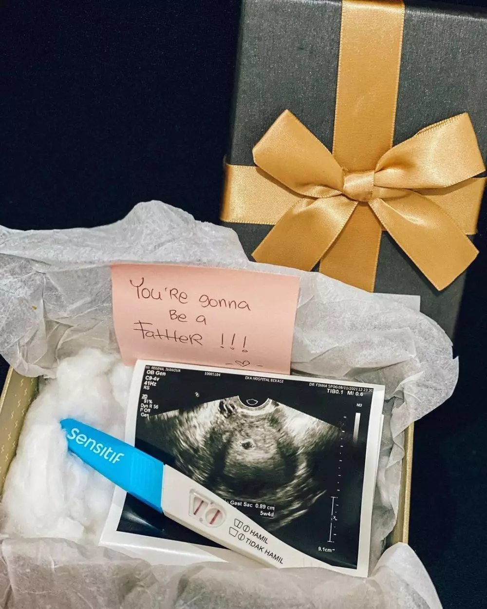 Kehamilan Regina Idol © Instagram