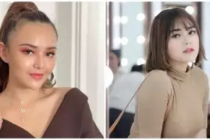 Potret perbedaan wajah Amanda Manopo sebelum dan usai perawatan