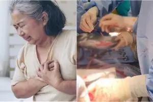 Ini alasan operasi jantung bisa diulang dan direkontruksi