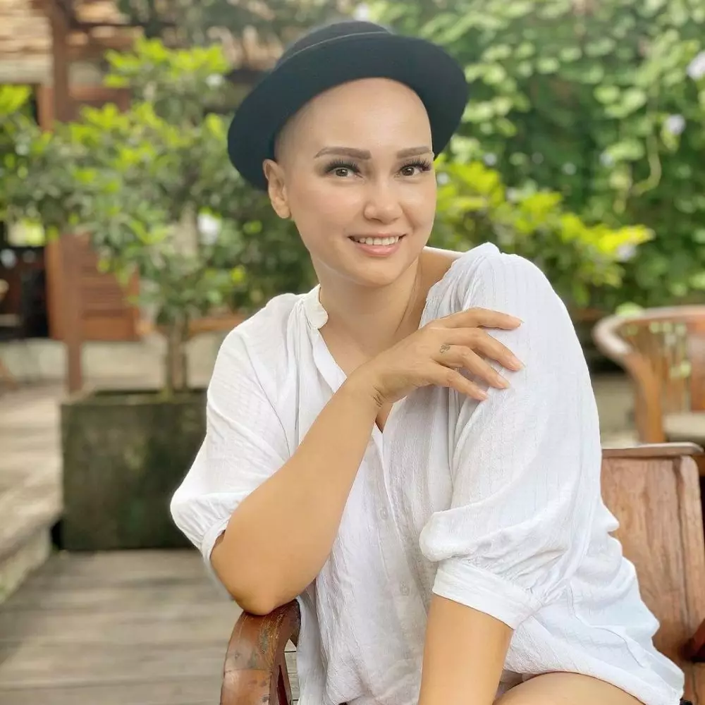 perjuangan seleb jalani kemoterapi © berbagai sumber