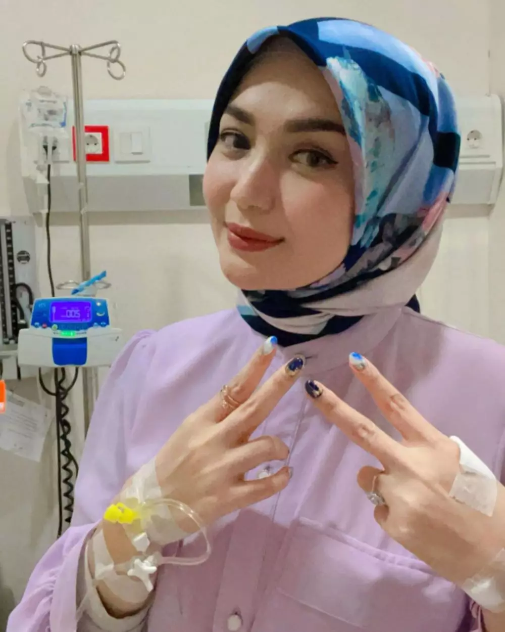 perjuangan seleb jalani kemoterapi © berbagai sumber