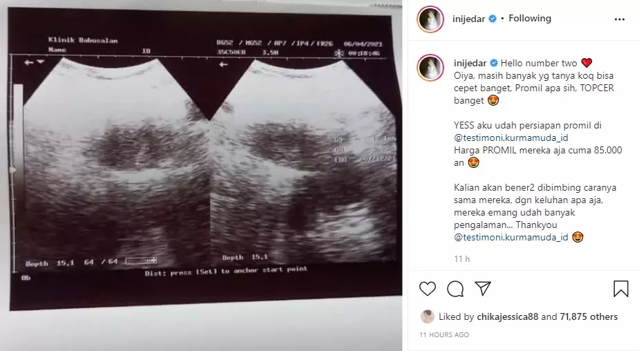 Jessica Iskandar unggah foto calon anak © 2021 Instagram