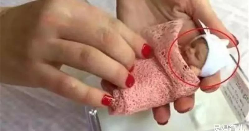 kabar bayi terkecil di dunia © 2021 brilio.net kabar bayi terkecil di dunia © 2021 brilio.net