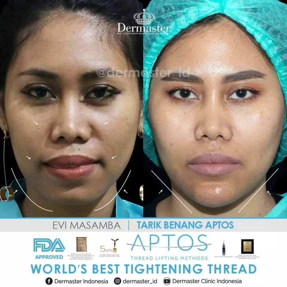 perubahan wajah Evi Masamba © 2021 brilio.net