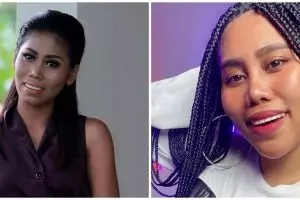 Potret perbedaan wajah Evi Masamba sebelum dan setelah tanam benang