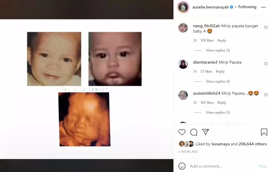 Aurel unggah foto USG terbaru © Instagram